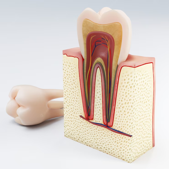 Root Canals pittsburgh pa